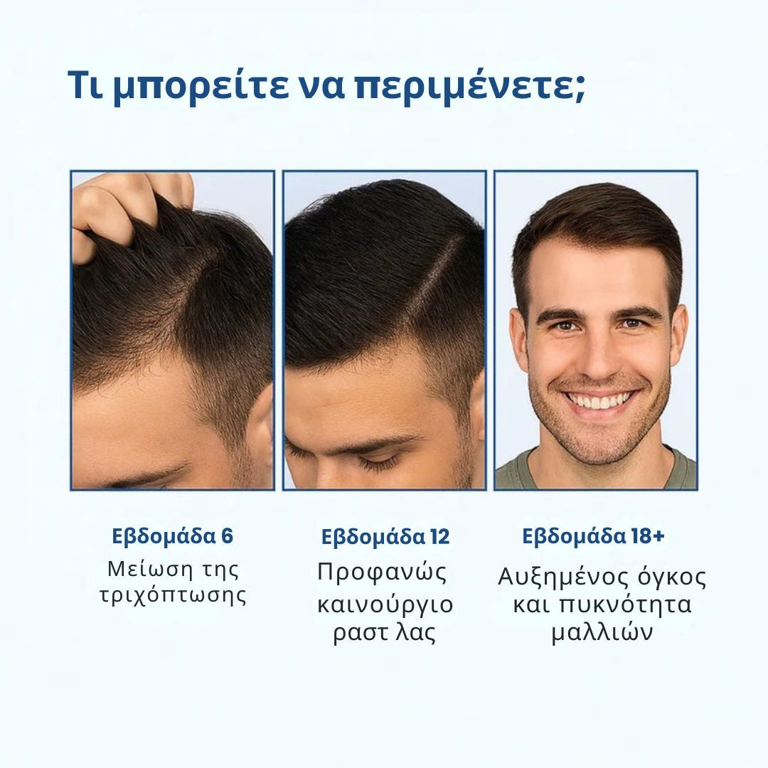 Daynava™ Roll-On για Ανάπτυξη Μαλλιών
