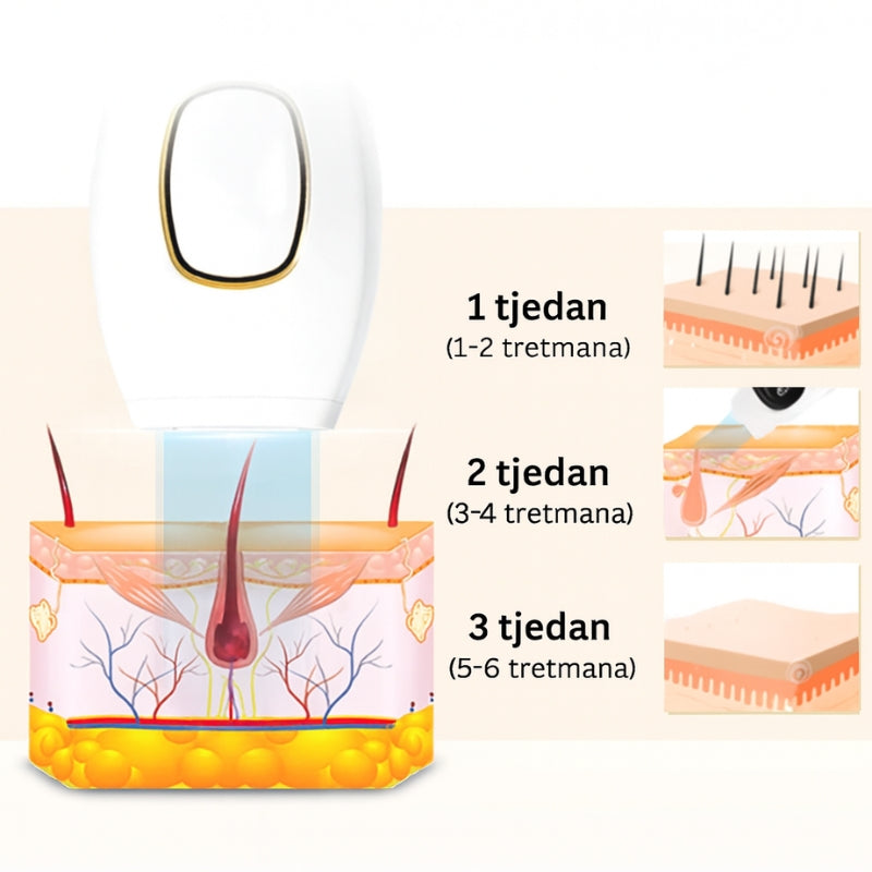 Daynava™ IPL Epilator (HR)