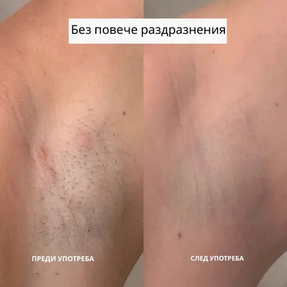 Daynava™ 5 в 1 Електрическа Самобръсначка