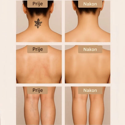 Daynava Set Četkica za Body Perfecter HR