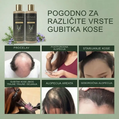 Šampon za rast kose