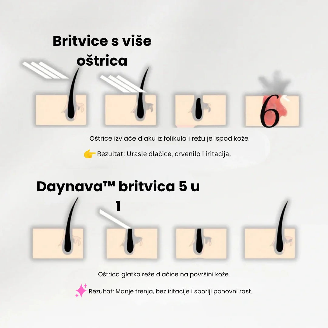 Daynava™ 5-u-1 Električni Brijač HR
