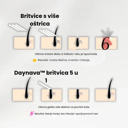 Daynava™ 5u1 Električni Brijaći Aparat