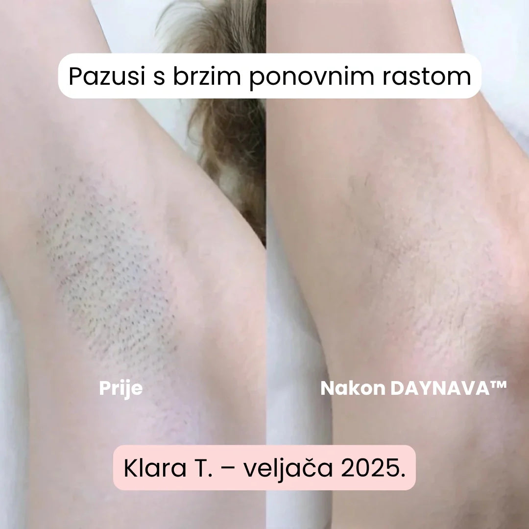 Daynava™ 5-u-1 Električni Brijač HR