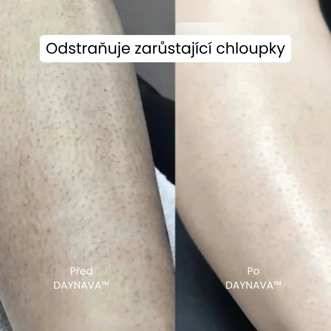 Daynava™ 5v1 Elektrický Holicí Strojek