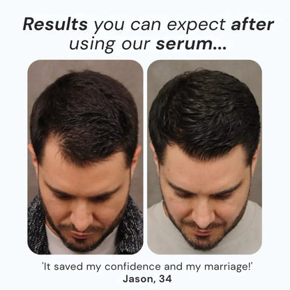 Daynava™ Roll-On for Hair Growth