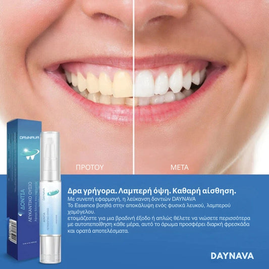 Daynava® Ουσία Λεύκανσης Δοντιών