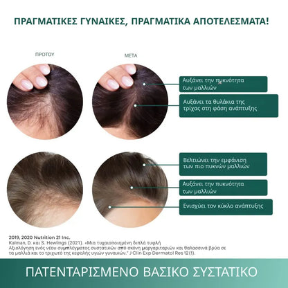 Βιταμίνες Βιοτίνης για Ανάπτυξη Μαλλιών