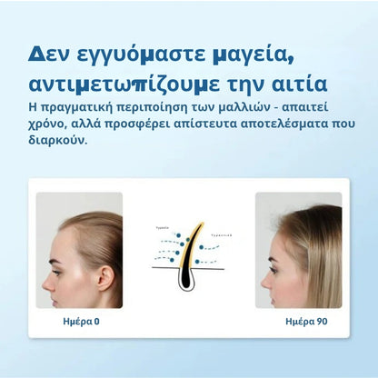 Daynava™ Roll-On για Ανάπτυξη Μαλλιών