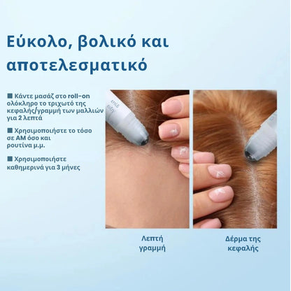 Daynava™ Roll-On για Ανάπτυξη Μαλλιών