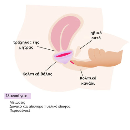 Κλασικός Εμμηνορροϊκός Δίσκος