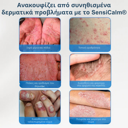 Καταπραϋντική Κρέμα για Τριχωτό & Δέρμα