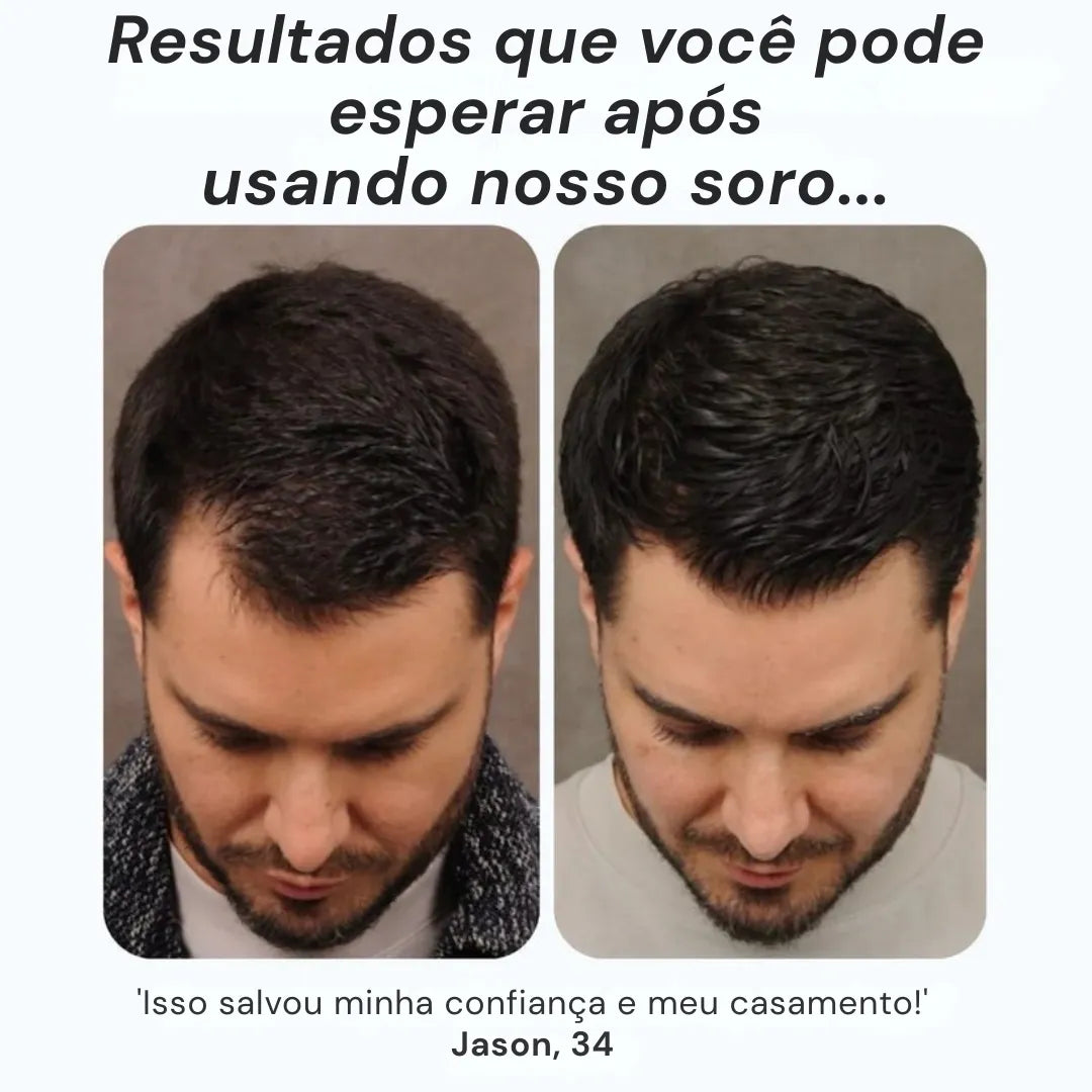 Daynava™ Roll-On para o Crescimento do Cabelo