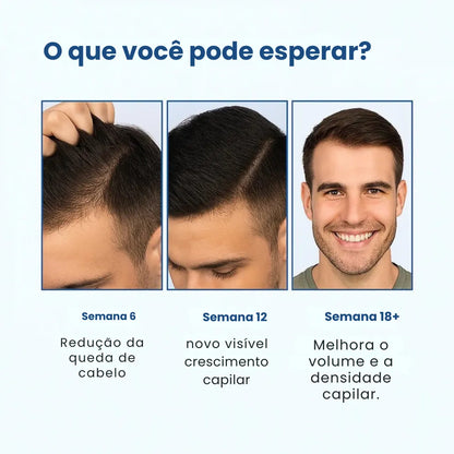 Daynava™ Roll-On para o Crescimento do Cabelo