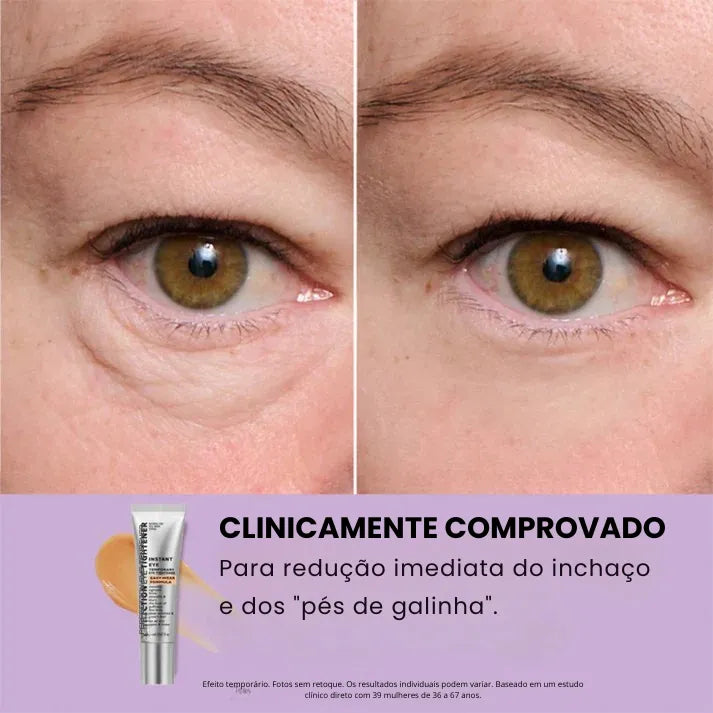 Daynava™ Lifting Instantâneo para os Olhos