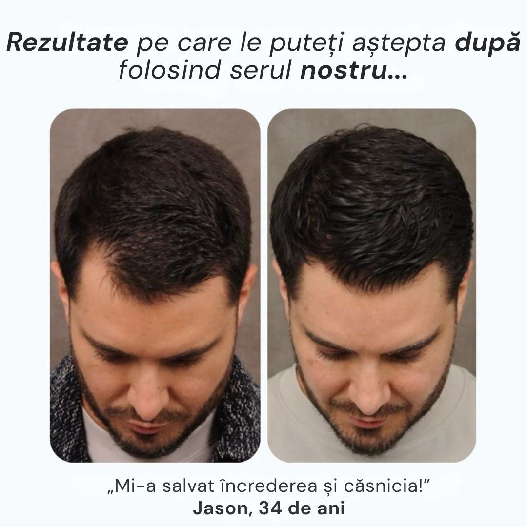 Daynava™ Roll-On pentru Creșterea Părului RO