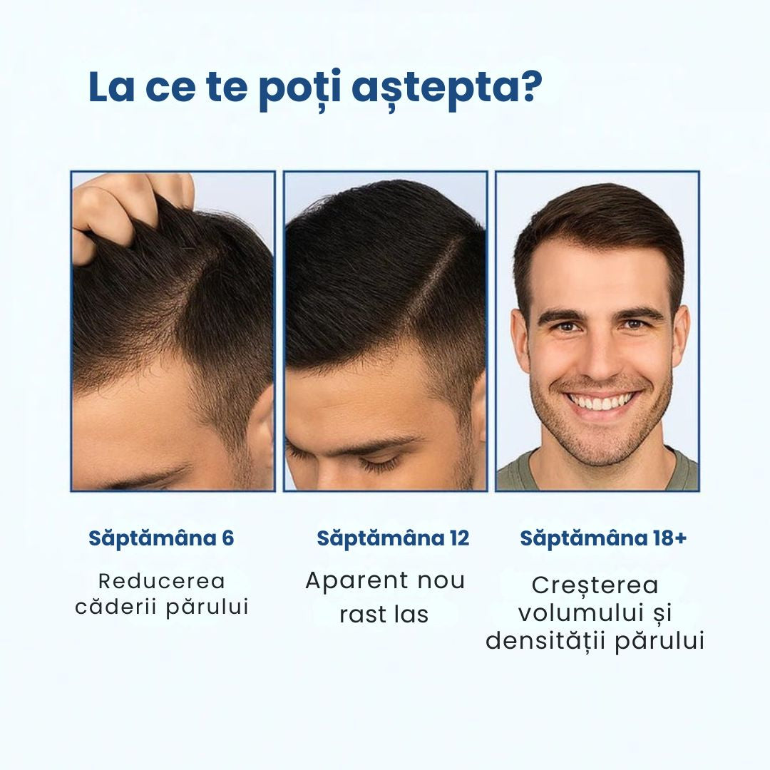 Daynava™ Roll-On pentru Creșterea Părului RO