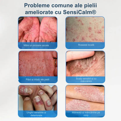 Cremă calmantă pentru scalp și piele RO