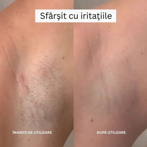 Daynava™ 5 în 1 Aparat de Ras Electric