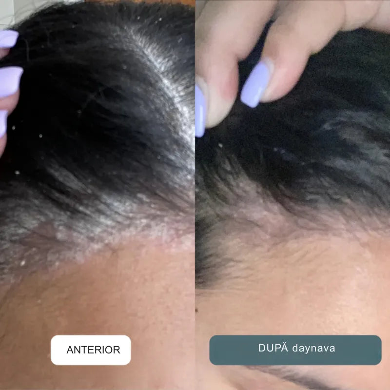 Cremă calmantă pentru scalp și piele RO