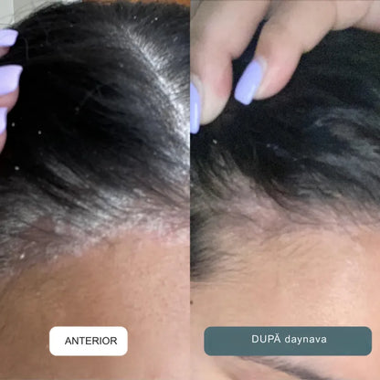 Cremă calmantă pentru scalp și piele RO