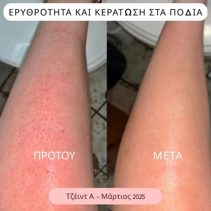 Daynava™ 5 - σε - 1 Ηλεκτρικό Ξυραφάκι - Daynava