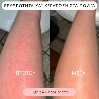 Daynava™ 5 - σε - 1 Ηλεκτρικό Ξυραφάκι - Daynava