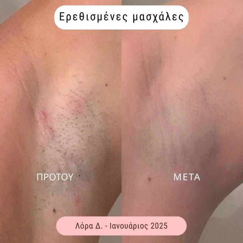 Daynava™ 5 - σε - 1 Ηλεκτρικό Ξυραφάκι - Daynava
