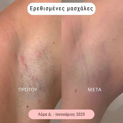 Daynava™ 5 - σε - 1 Ηλεκτρικό Ξυραφάκι - Daynava