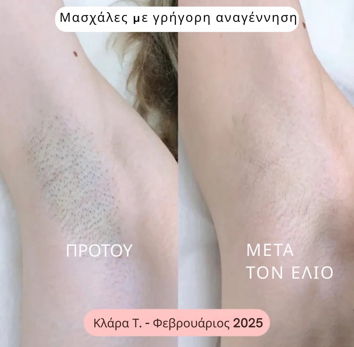 Daynava™ 5 - σε - 1 Ηλεκτρικό Ξυραφάκι - Daynava