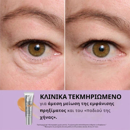 Daynava™ Άμεσος Ανυψωτής Ματιών - Daynava