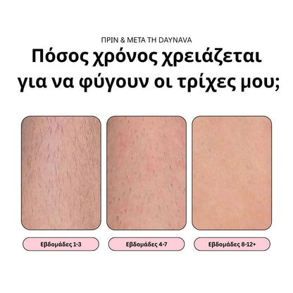 Daynava™ IPL Αποτρίχωσης - Daynava