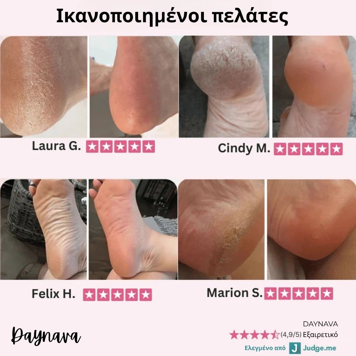 Ηλεκτρική Λίμα Ποδιών Daynava - Daynava